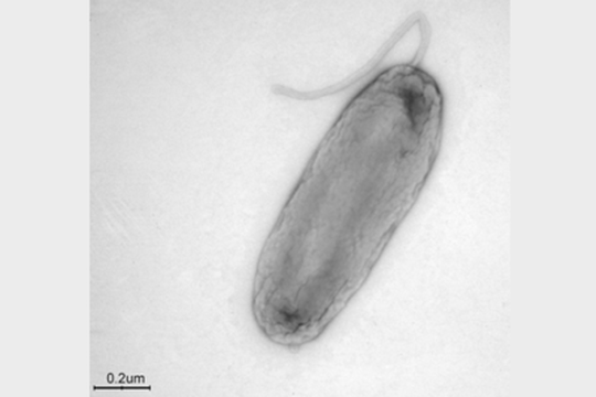 Legionella bononiensis: individuata una nuova specie di Legionella